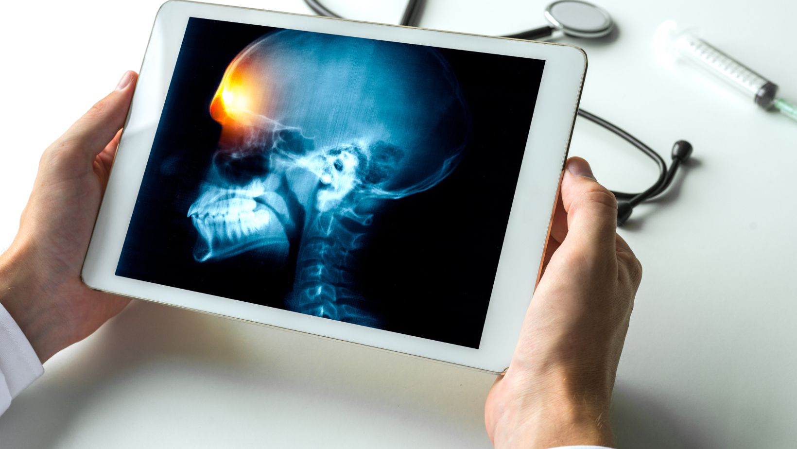 A Cirurgia de Cabeça e Pescoço é uma especialidade médica e cirúrgica que se dedica ao diagnóstico, tratamento e manejo de doenças que afetam a região da cabeça e pescoço.